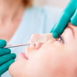 Türkiye’de yapılan estetik operasyonlar İsviçre sağlık sistemini zorluyor