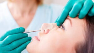 Türkiye’de yapılan estetik operasyonlar İsviçre sağlık sistemini zorluyor